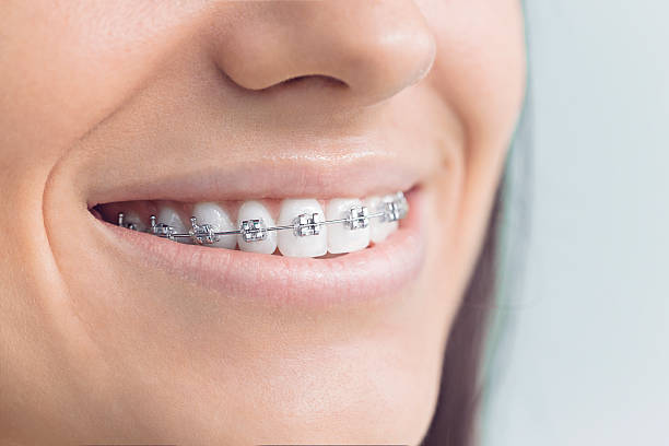 Best Invisalign and Clear Aligners  in West Rson, CA